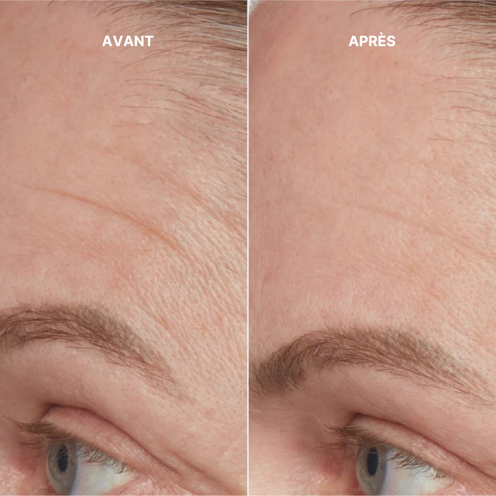 Abonnement - Sérum Peptide Effet Repulpant